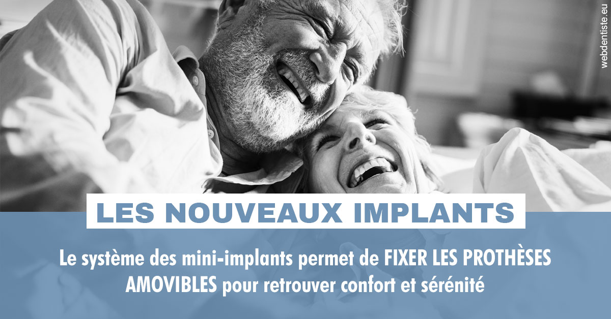 https://www.dr-magrou-limoux-dentiste.fr/Les nouveaux implants 2