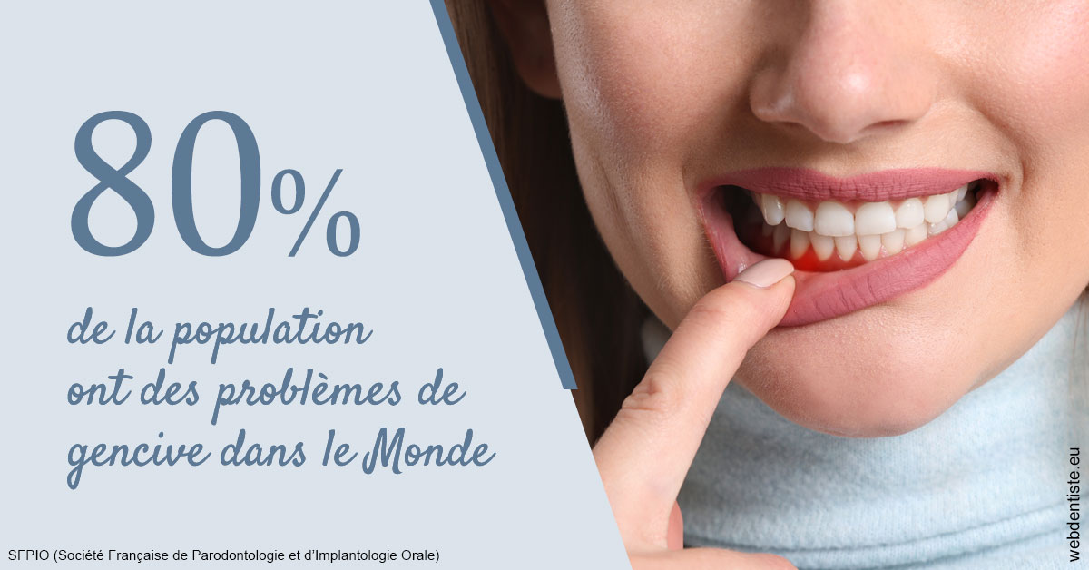 https://www.dr-magrou-limoux-dentiste.fr/Problèmes de gencive 2