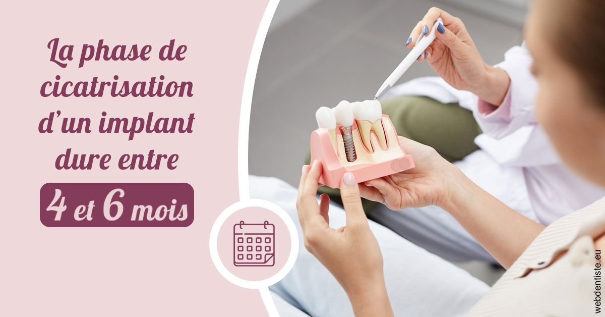 https://www.dr-magrou-limoux-dentiste.fr/Cicatrisation implant 2