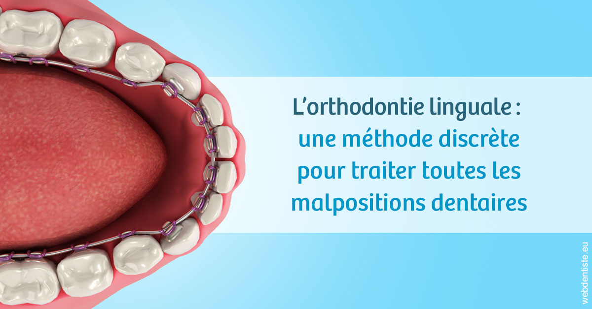 https://www.dr-magrou-limoux-dentiste.fr/L'orthodontie linguale 1