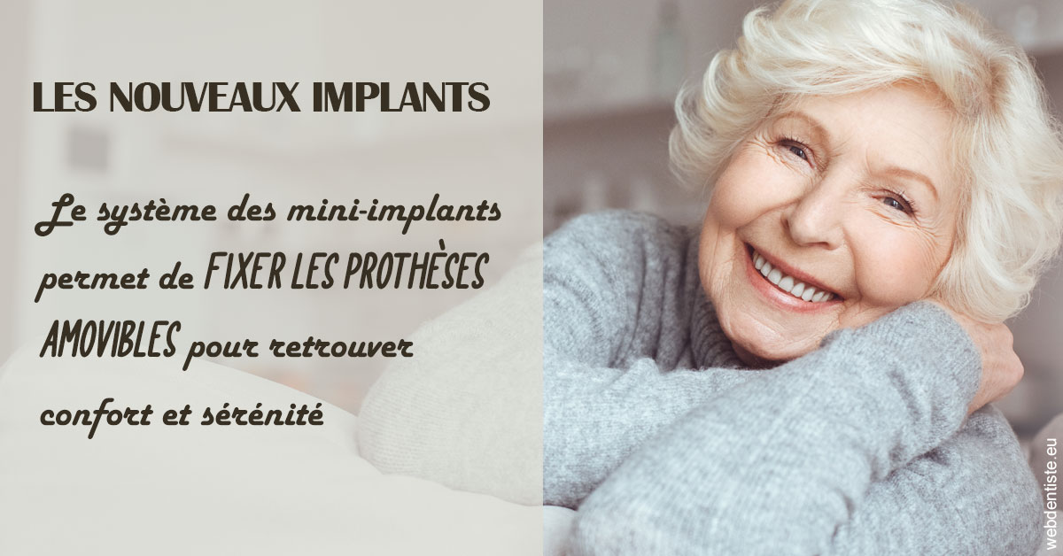 https://www.dr-magrou-limoux-dentiste.fr/Les nouveaux implants 1