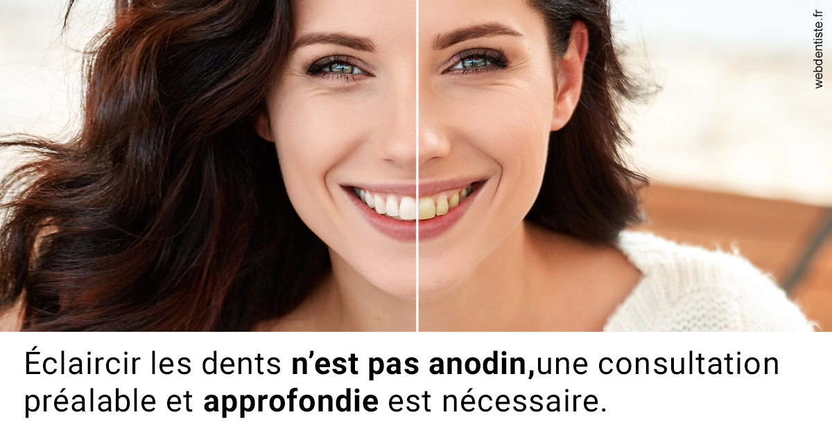 https://www.dr-magrou-limoux-dentiste.fr/Le blanchiment 2