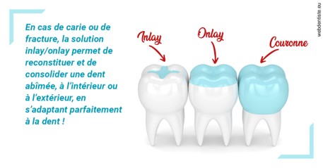https://www.dr-magrou-limoux-dentiste.fr/L'INLAY ou l'ONLAY