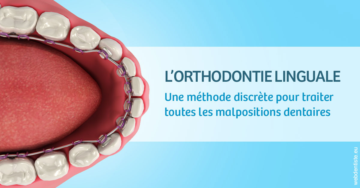 https://www.dr-magrou-limoux-dentiste.fr/L'orthodontie linguale 1