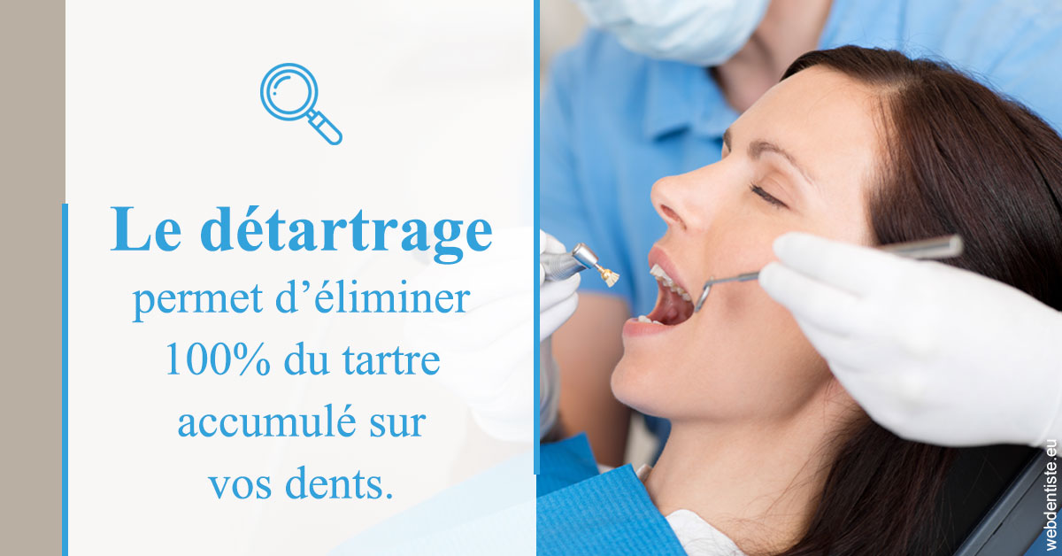https://www.dr-magrou-limoux-dentiste.fr/En quoi consiste le détartrage