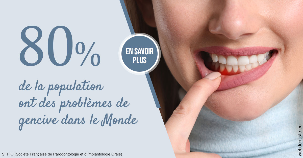 https://www.dr-magrou-limoux-dentiste.fr/Problèmes de gencive 2