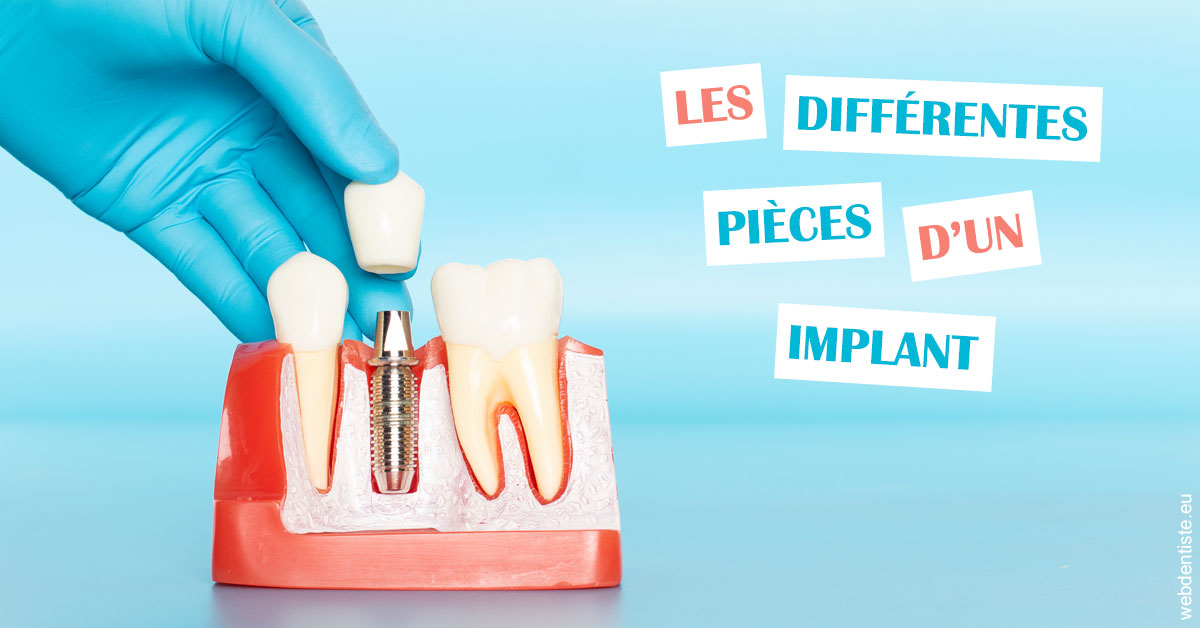 https://www.dr-magrou-limoux-dentiste.fr/Les différentes pièces d’un implant 2