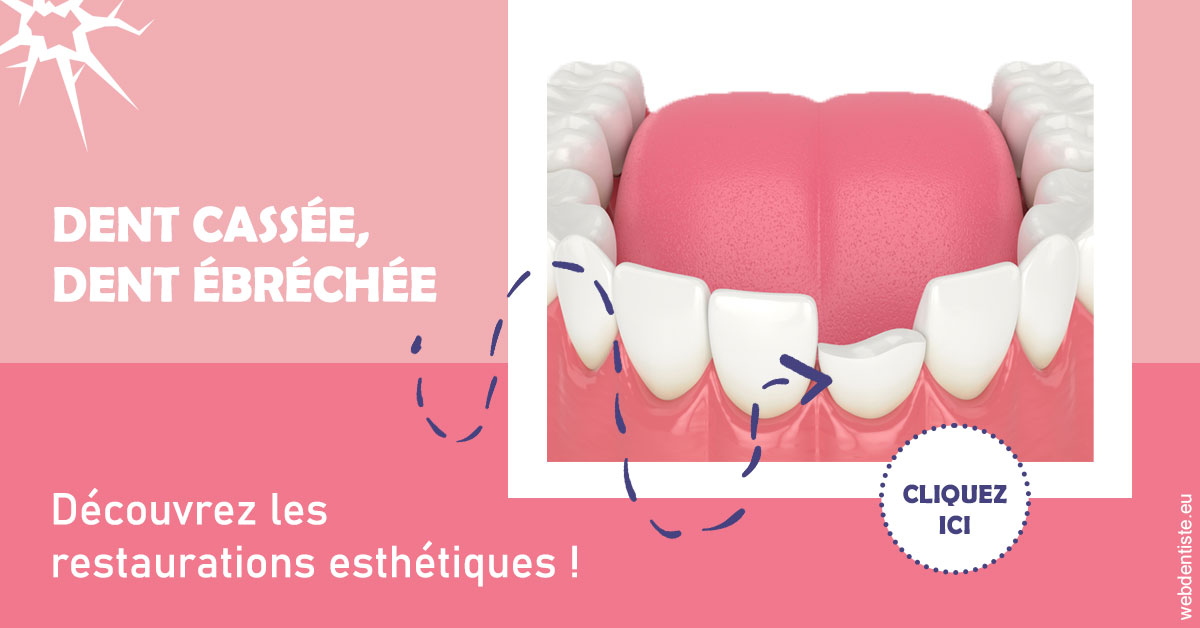 https://www.dr-magrou-limoux-dentiste.fr/Dent cassée ébréchée 1