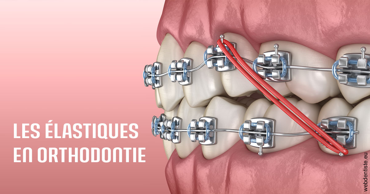 https://www.dr-magrou-limoux-dentiste.fr/Elastiques orthodontie 2