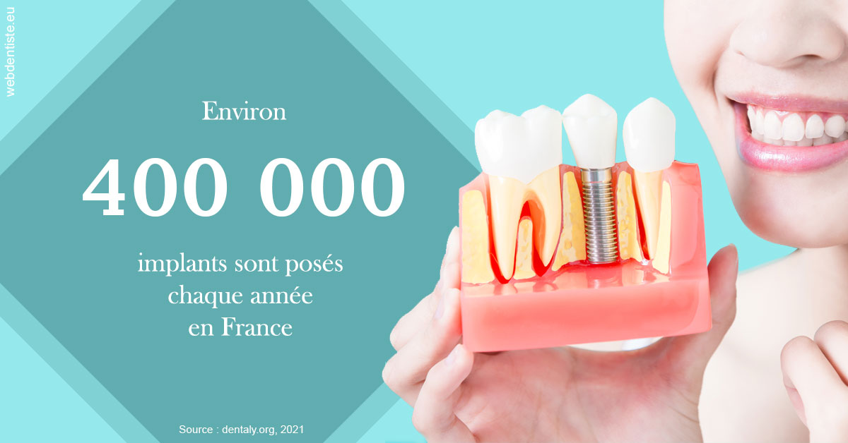 https://www.dr-magrou-limoux-dentiste.fr/Pose d'implants en France 2
