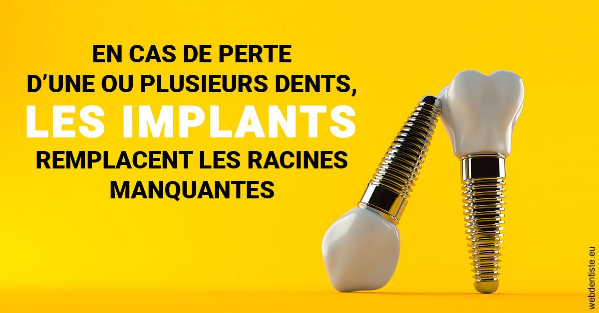 https://www.dr-magrou-limoux-dentiste.fr/Les implants 2