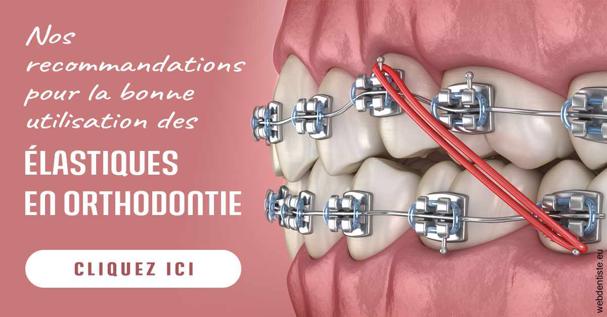 https://www.dr-magrou-limoux-dentiste.fr/Elastiques orthodontie 2