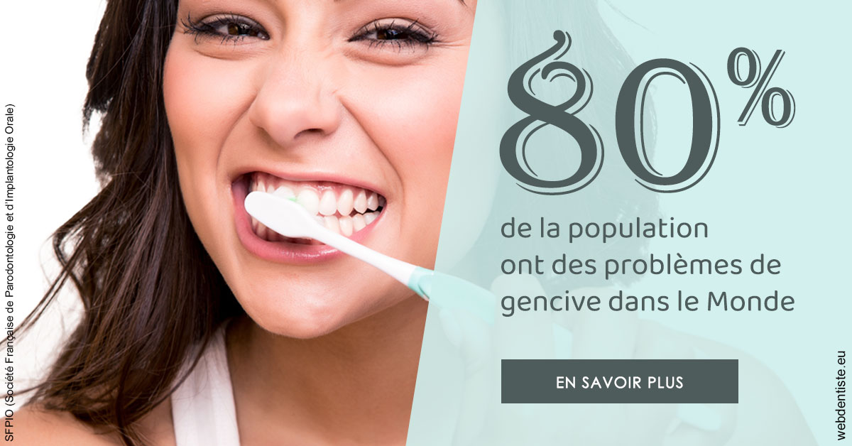 https://www.dr-magrou-limoux-dentiste.fr/Problèmes de gencive 1