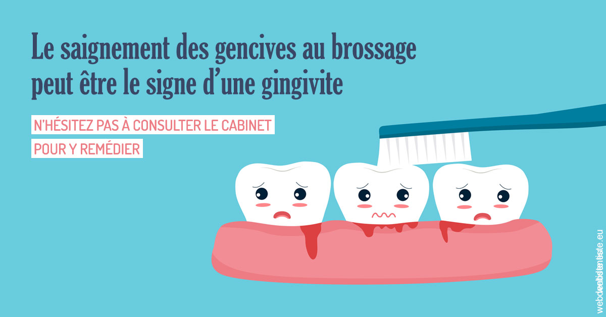 https://www.dr-magrou-limoux-dentiste.fr/2023 T4 - Saignement des gencives 02